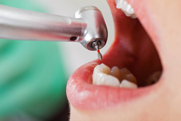 Best Emergency Dental Services for Seniors in Fayetteville, AL